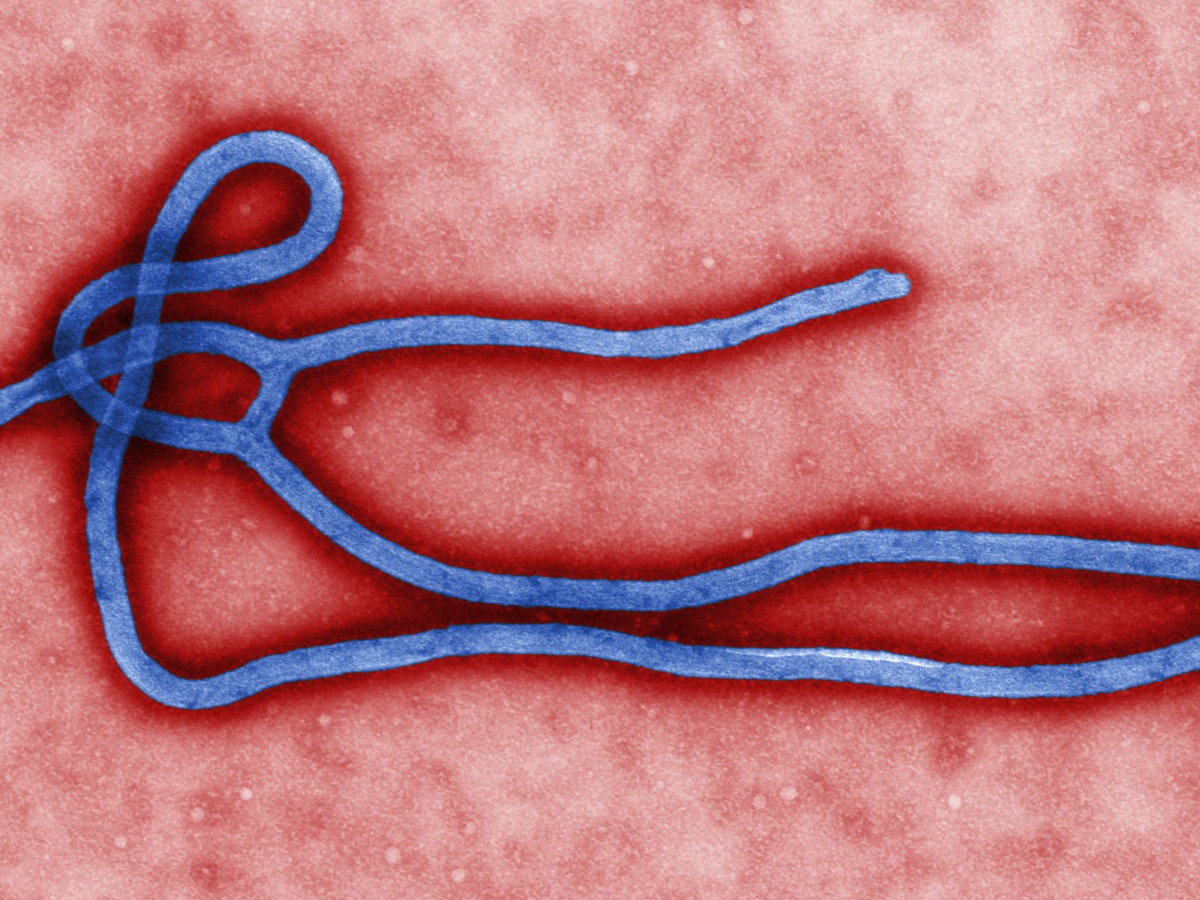 Ebola Virus. Foto: CC BY-SA 2.0 | Global Panorama/ flickr.com