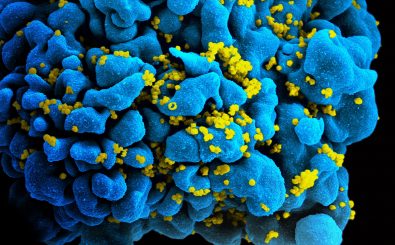 HI-Viren auf einer infizierten T-Zelle. / Foto: HIV-infected T cell | CC BY 2.0 | NIAID | flickr.com
