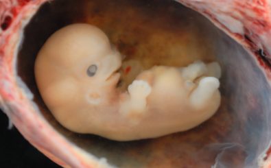 Befruchtete Eizellen sind noch kein Fötus wie hier auf dem Bild. Foto: Embryo @ 6- 7 weeks | CC BY 2.0 | lunar caustic / flickr.com