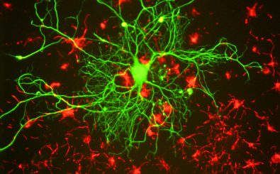 Neuron unter dem Fluoreszenzmikroskop. Foto:  Biotechnology Gerry Shaw (EnCor Biotechnology) / wikimedia / CC BY 3.0