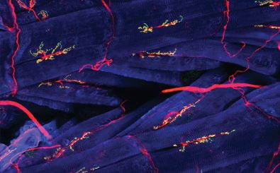 Die grün gefärbten Neto-Proteine zeigen die Reizweiterleitung im Muskel. Foto: Fruit fly muscles / Credit: NICHD/Y.J. Kim and M. Serpe CC BY 2.0 | NICHD / flickr.com