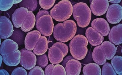 Gonokokken (Neisseria gonorrhoeae) sind die beweglichen Bakterien, die die Infektionskrankheit Tripper auslösen. Foto: Neisseria gonorrhoeae Bacteria | CC BY 2.0 | NIAID / flickr.com