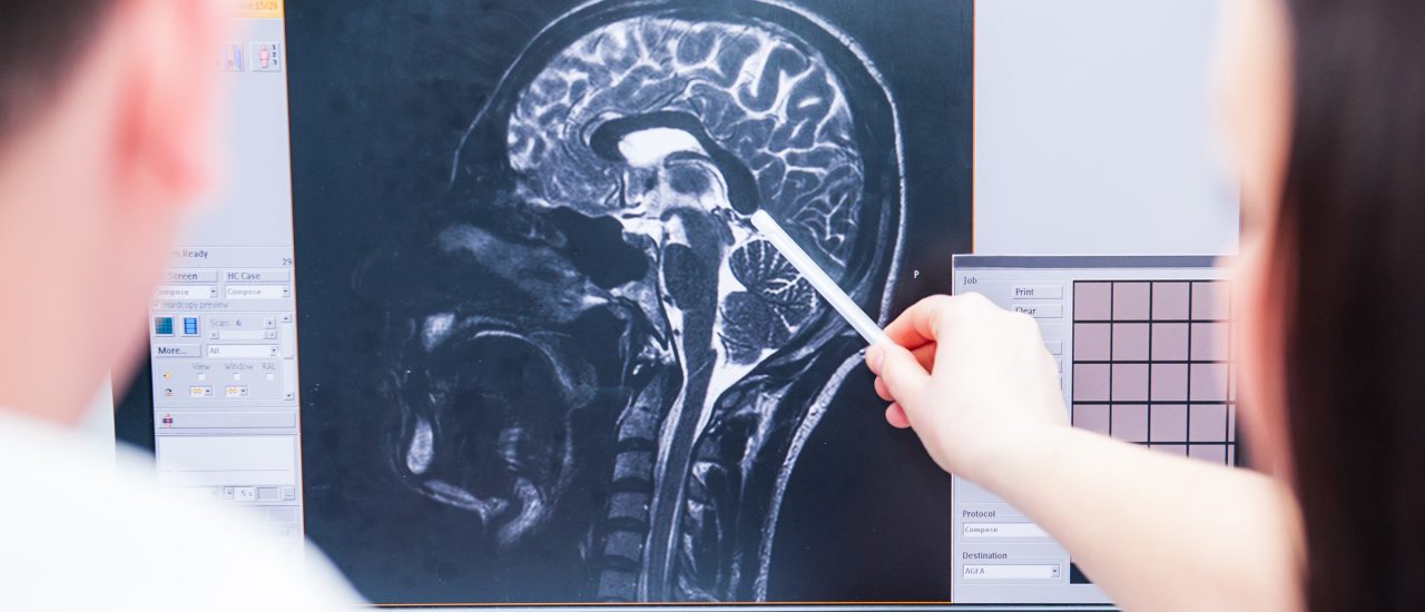 Die Reaktionen des Gehirns auf den eigenen Tod konnten die Forscher am Bildschirm verfolgen. Foto: Okrasyuk | Shutterstock