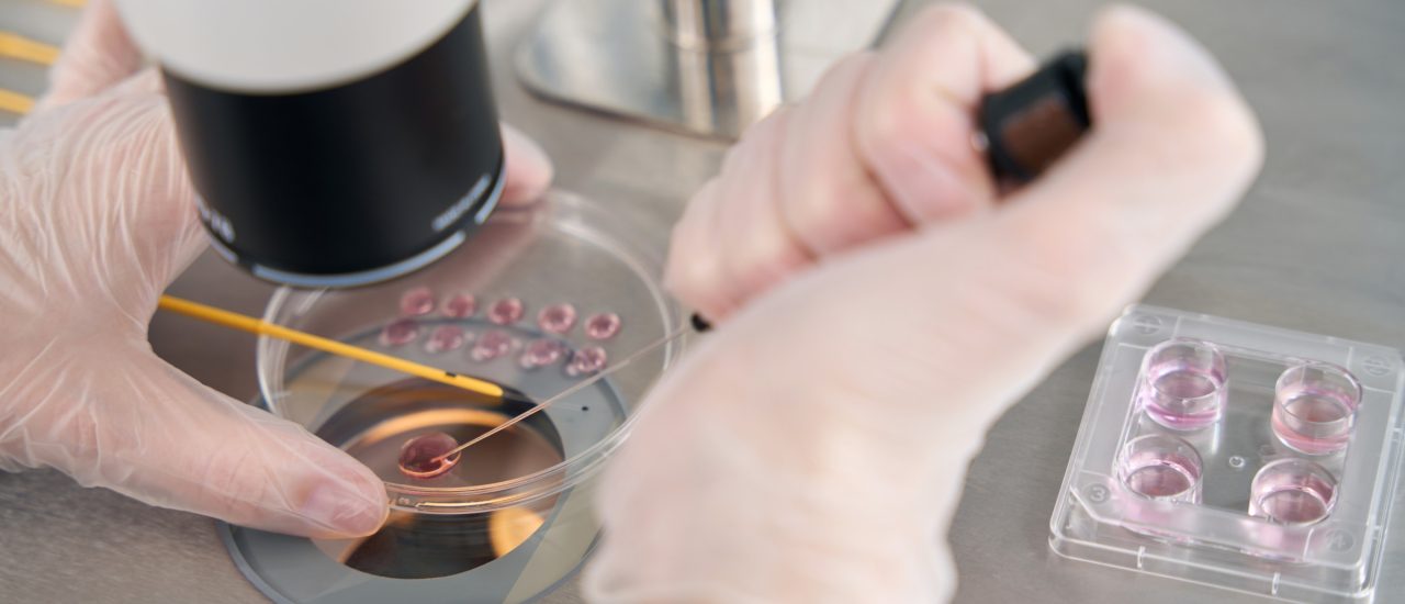 Gibt es bald Embryonen aus dem Labor? 